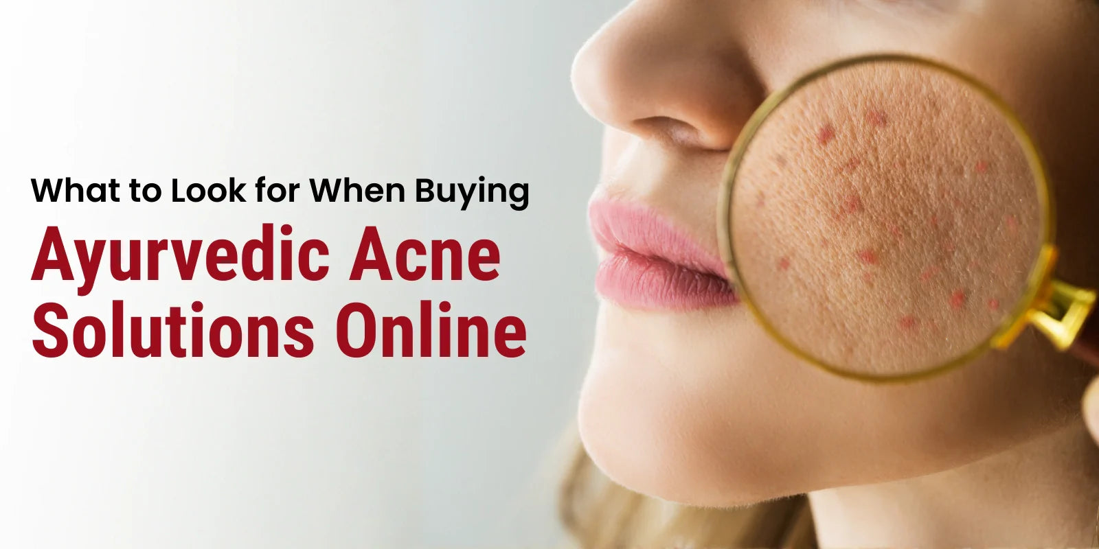 What to Look for When Buying Ayurvedic Acne Solutions Online